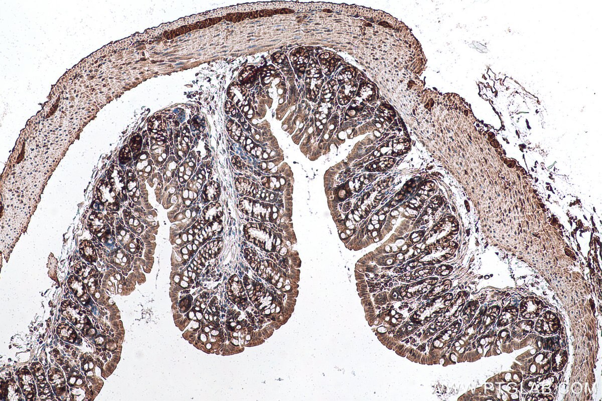 Immunohistochemical analysis of paraffin-embedded mouse colon tissue slide using KHC0957 (PDAP1 IHC Kit).