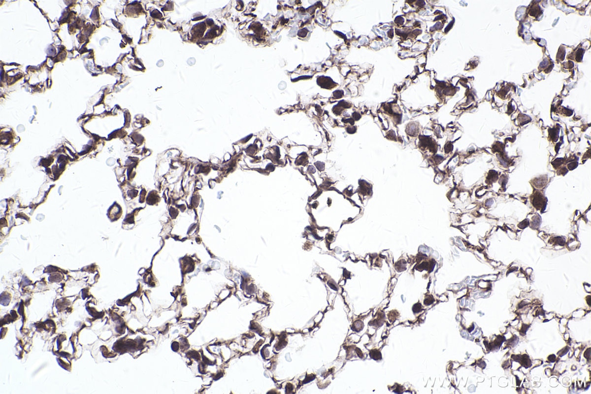 Immunohistochemical analysis of paraffin-embedded mouse lung tissue slide using KHC2466 (PDCD11 IHC Kit).