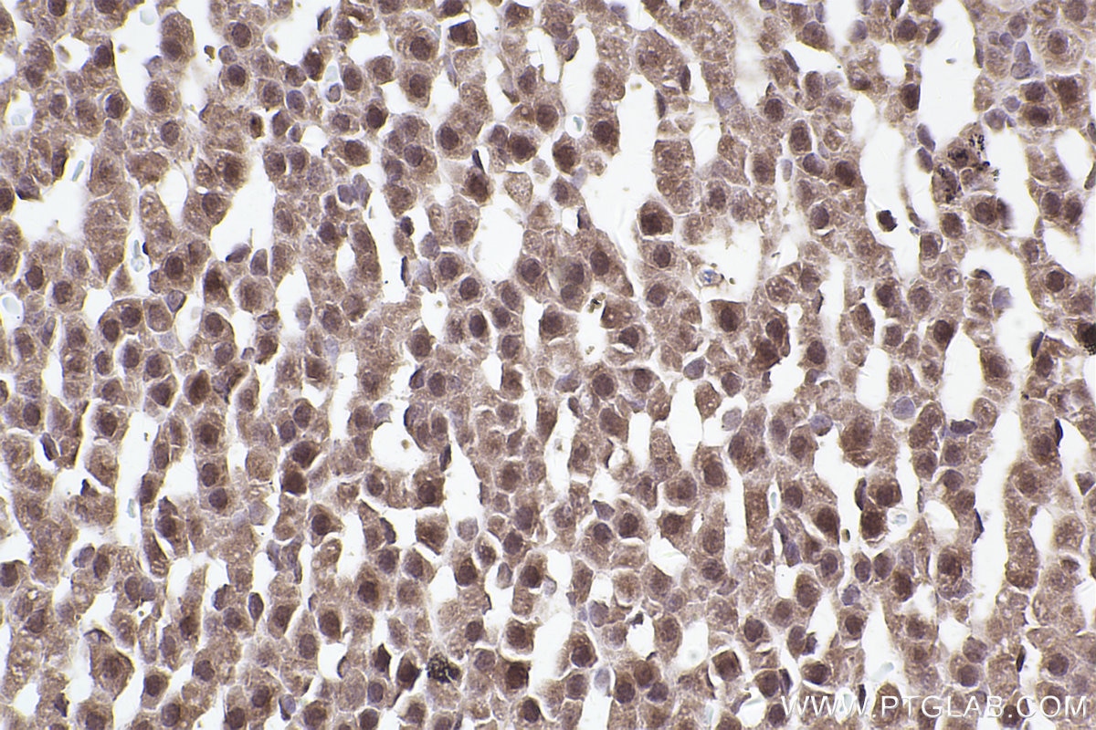 Immunohistochemical analysis of paraffin-embedded rat adrenal gland tissue slide using KHC2466 (PDCD11 IHC Kit).