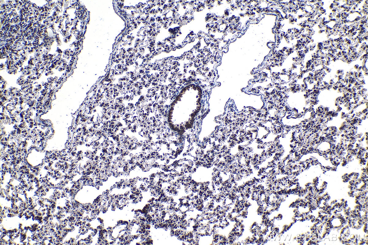 Immunohistochemical analysis of paraffin-embedded rat lung tissue slide using KHC1048 (PDCD6 IHC Kit).