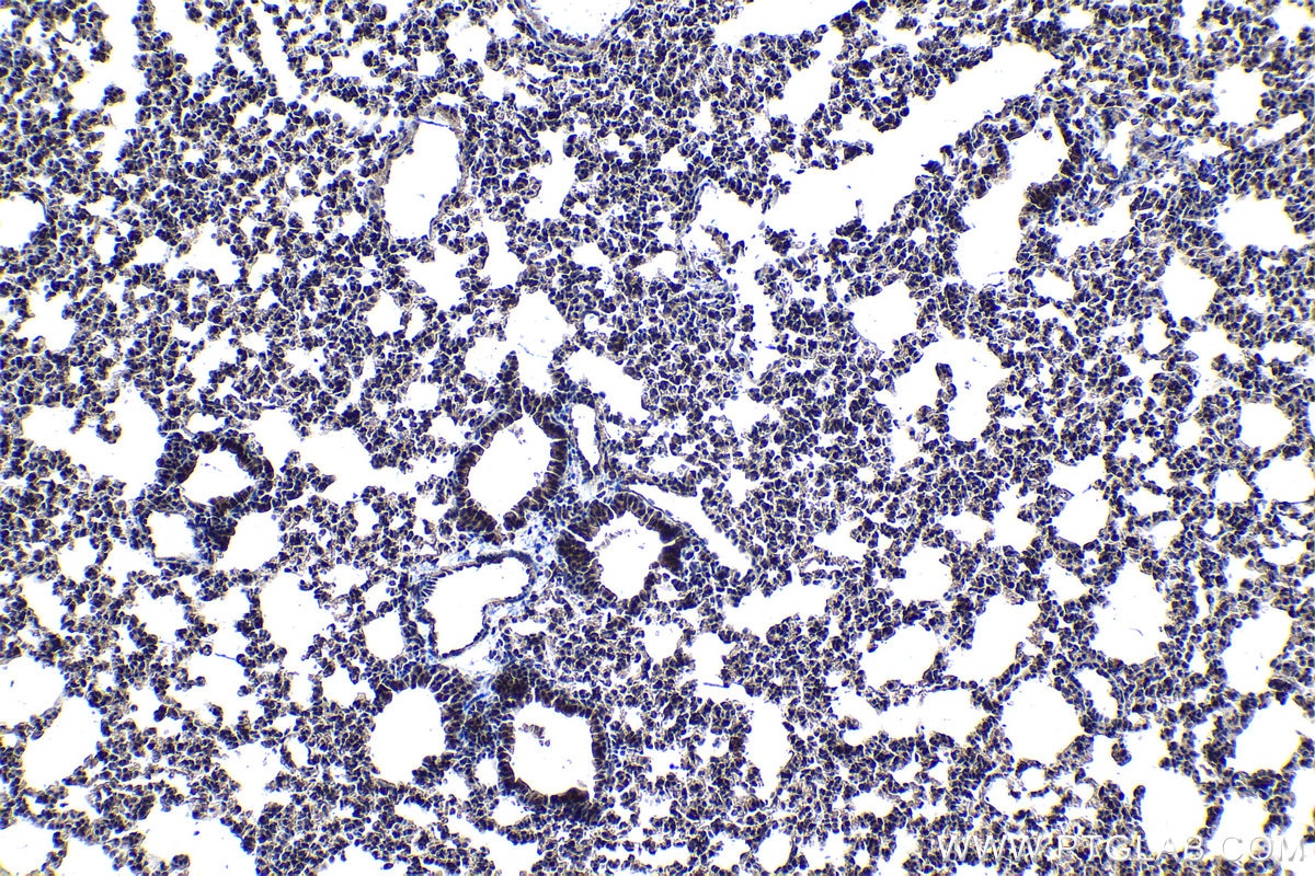 Immunohistochemical analysis of paraffin-embedded mouse lung tissue slide using KHC1048 (PDCD6 IHC Kit).