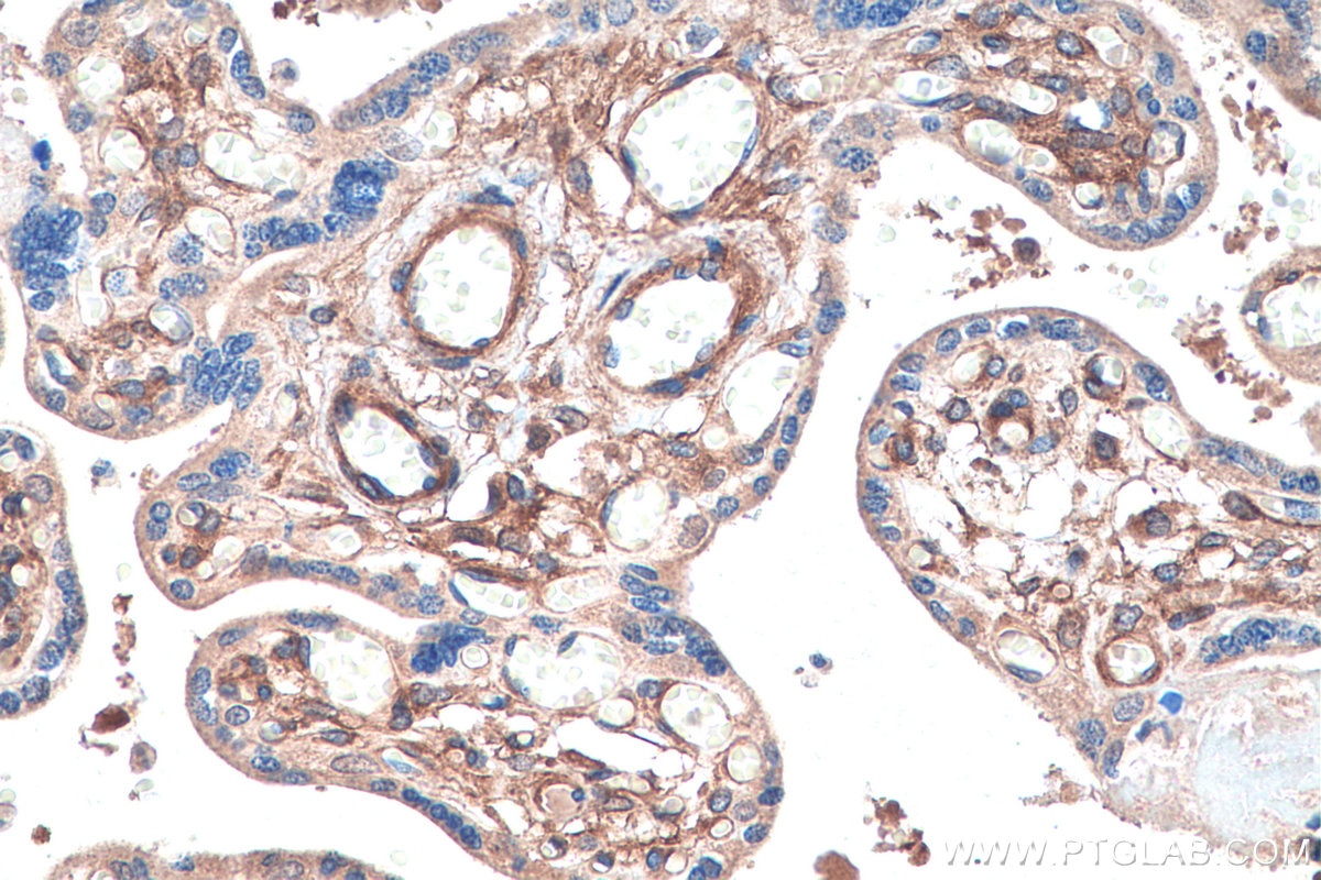 Immunohistochemical analysis of paraffin-embedded human placenta tissue slide using KHC0224 (PDGFRB IHC Kit).