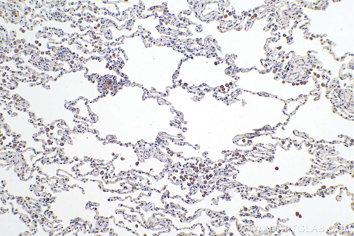 Immunohistochemical analysis of paraffin-embedded human lung tissue slide using KHC0817 (PDGFRL IHC Kit).