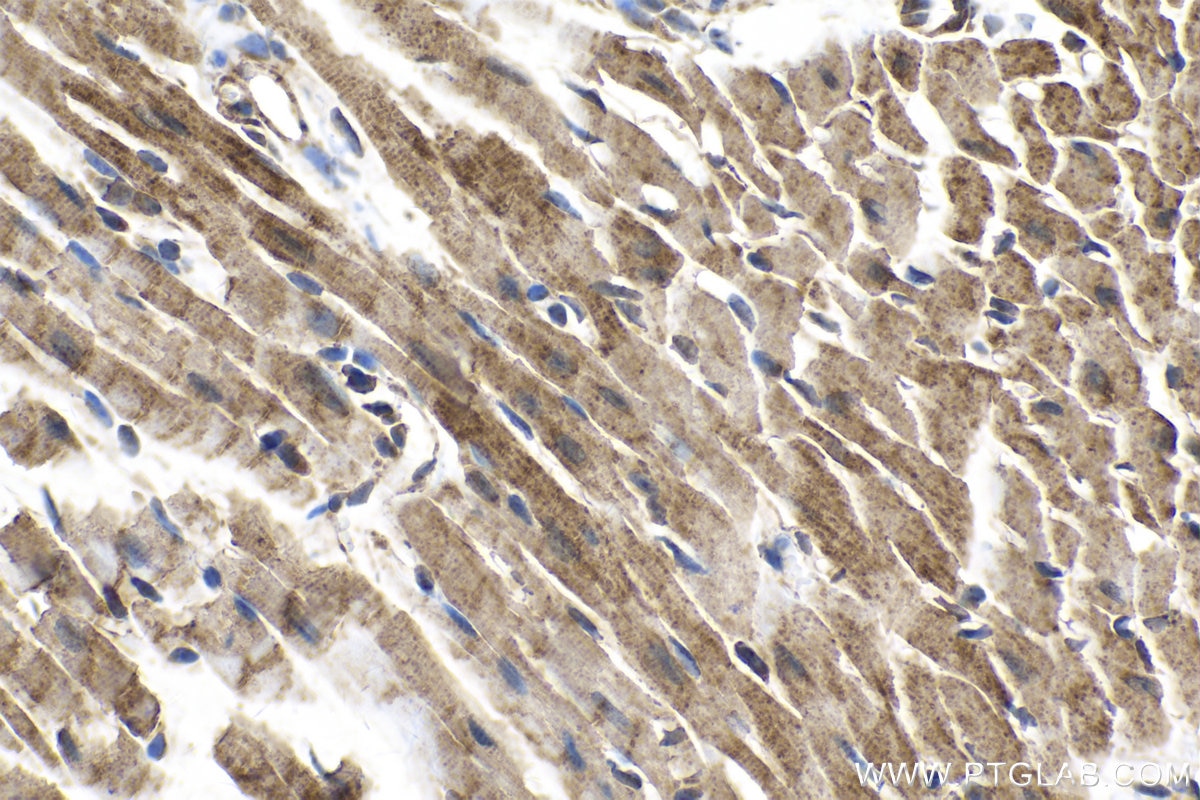 Immunohistochemical analysis of paraffin-embedded mouse heart tissue slide using KHC2169 (PDHA1 IHC Kit).