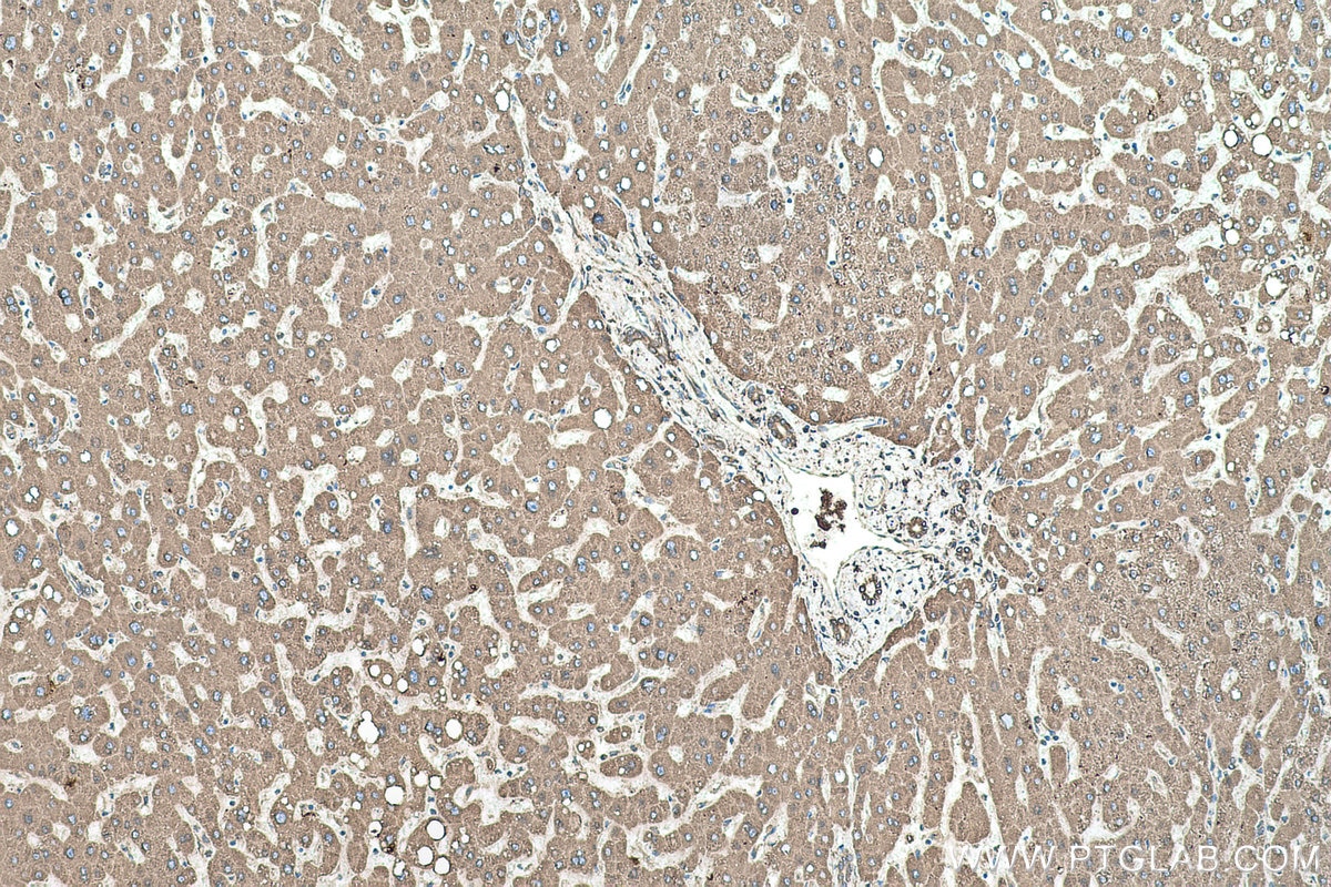 Immunohistochemical analysis of paraffin-embedded human liver tissue slide using KHC0516 (PDI/P4HB IHC Kit).