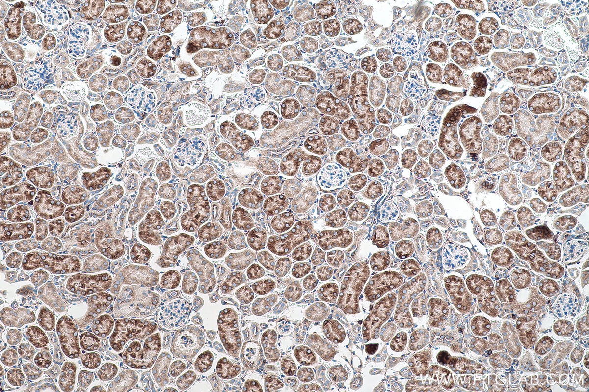 Immunohistochemical analysis of paraffin-embedded mouse kidney tissue slide using KHC0516 (PDI/P4HB IHC Kit).