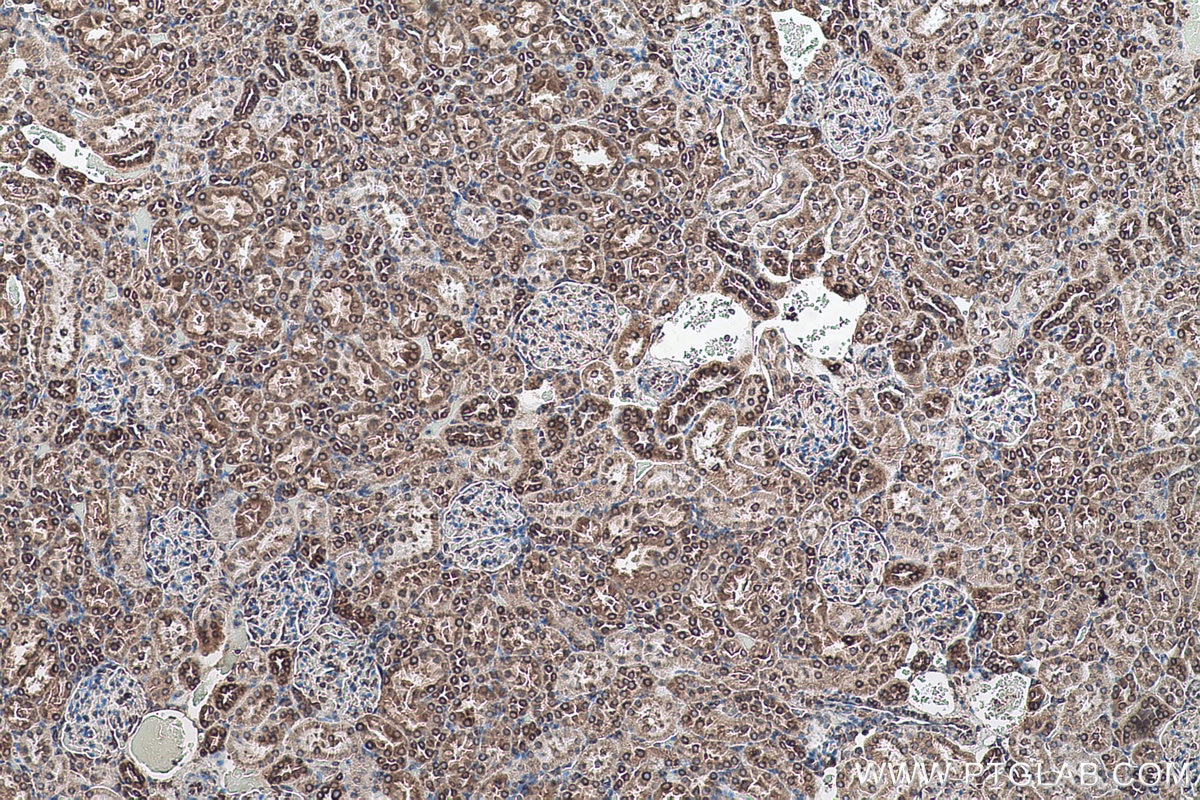 Immunohistochemical analysis of paraffin-embedded rat kidney tissue slide using KHC0516 (PDI/P4HB IHC Kit).