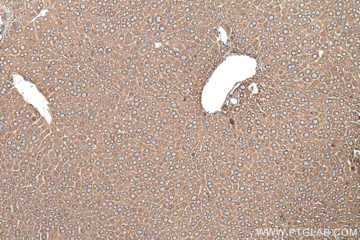 Immunohistochemical analysis of paraffin-embedded mouse liver tissue slide using KHC0584 (PDIA4/ERP72 IHC Kit).