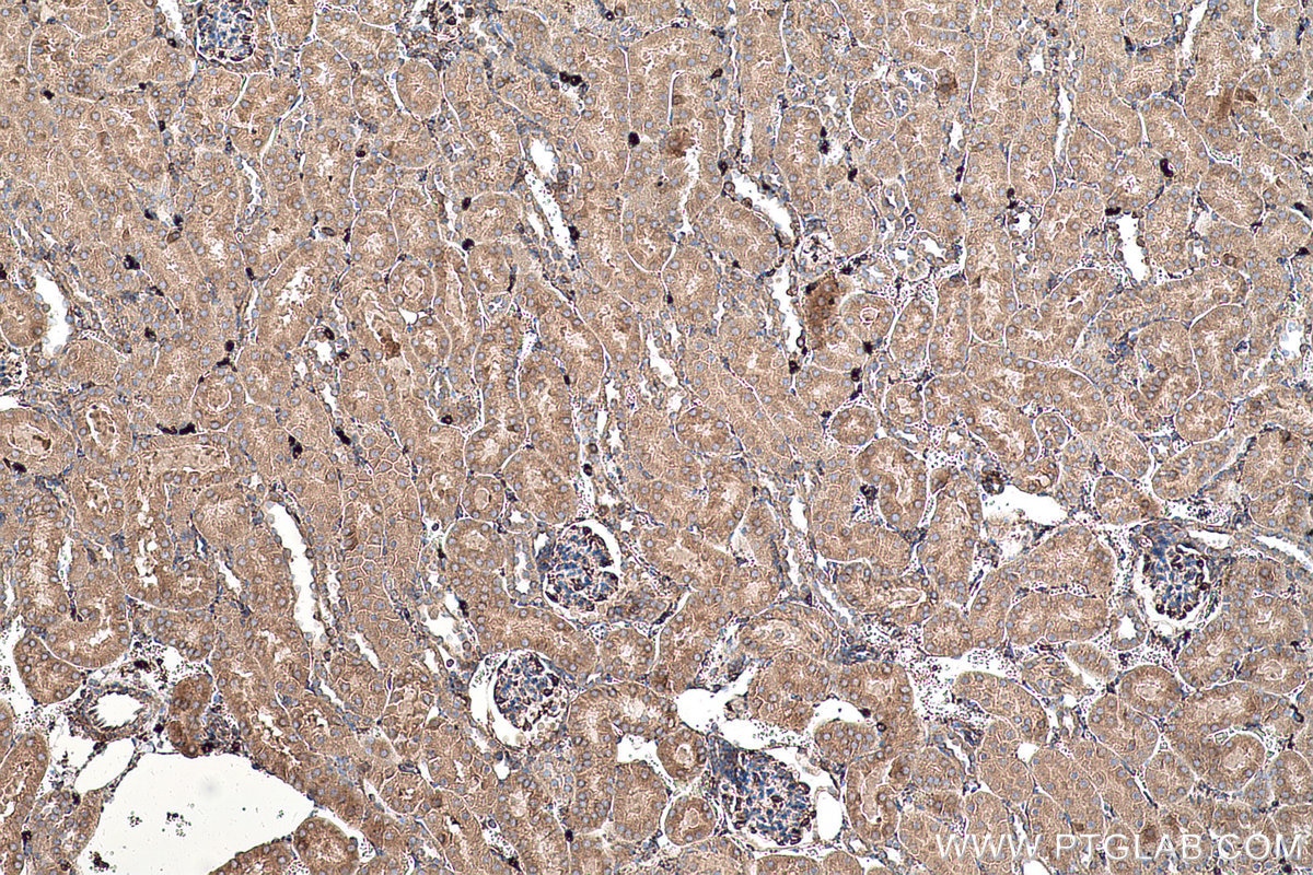 Immunohistochemical analysis of paraffin-embedded mouse kidney tissue slide using KHC0584 (PDIA4/ERP72 IHC Kit).