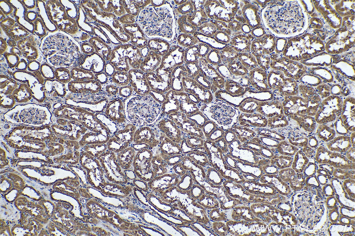 Immunohistochemical analysis of paraffin-embedded human kidney tissue slide using KHC0579 (PDIA6 IHC Kit).