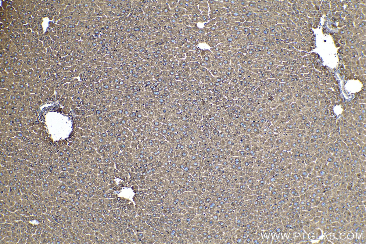 Immunohistochemical analysis of paraffin-embedded mouse liver tissue slide using KHC0579 (PDIA6 IHC Kit).