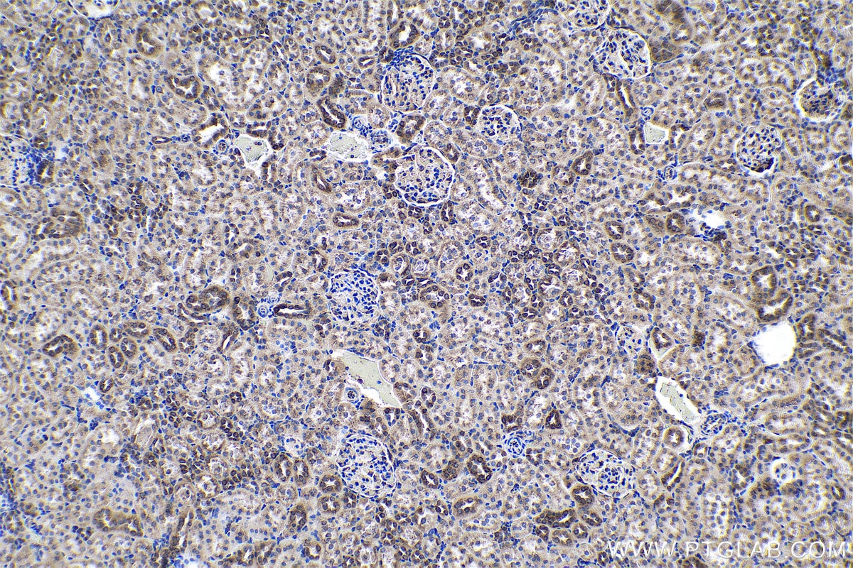 Immunohistochemical analysis of paraffin-embedded rat kidney tissue slide using KHC0579 (PDIA6 IHC Kit).