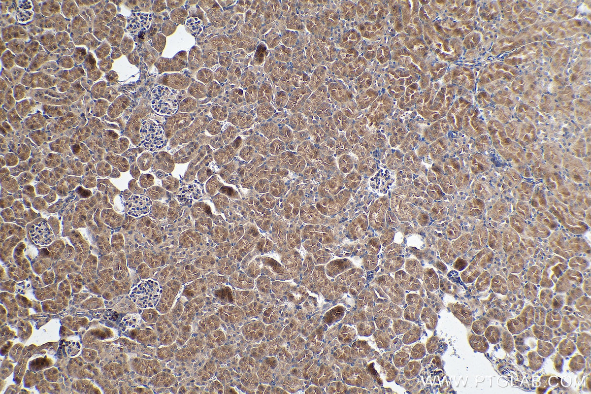 Immunohistochemical analysis of paraffin-embedded mouse kidney tissue slide using KHC0190 (PDK1 IHC Kit).