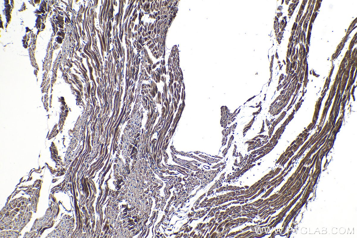 Immunohistochemical analysis of paraffin-embedded mouse heart tissue slide using KHC1164 (PDK4 IHC Kit).