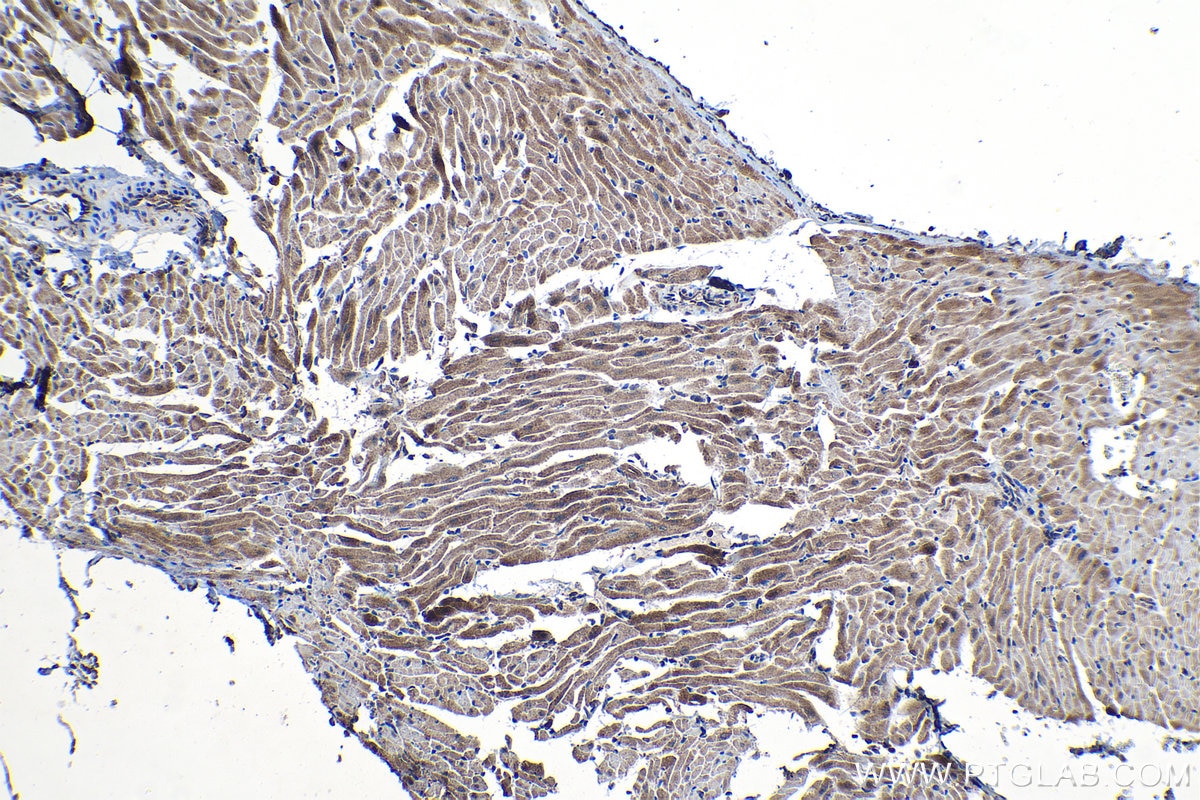 Immunohistochemical analysis of paraffin-embedded rat heart tissue slide using KHC1164 (PDK4 IHC Kit).