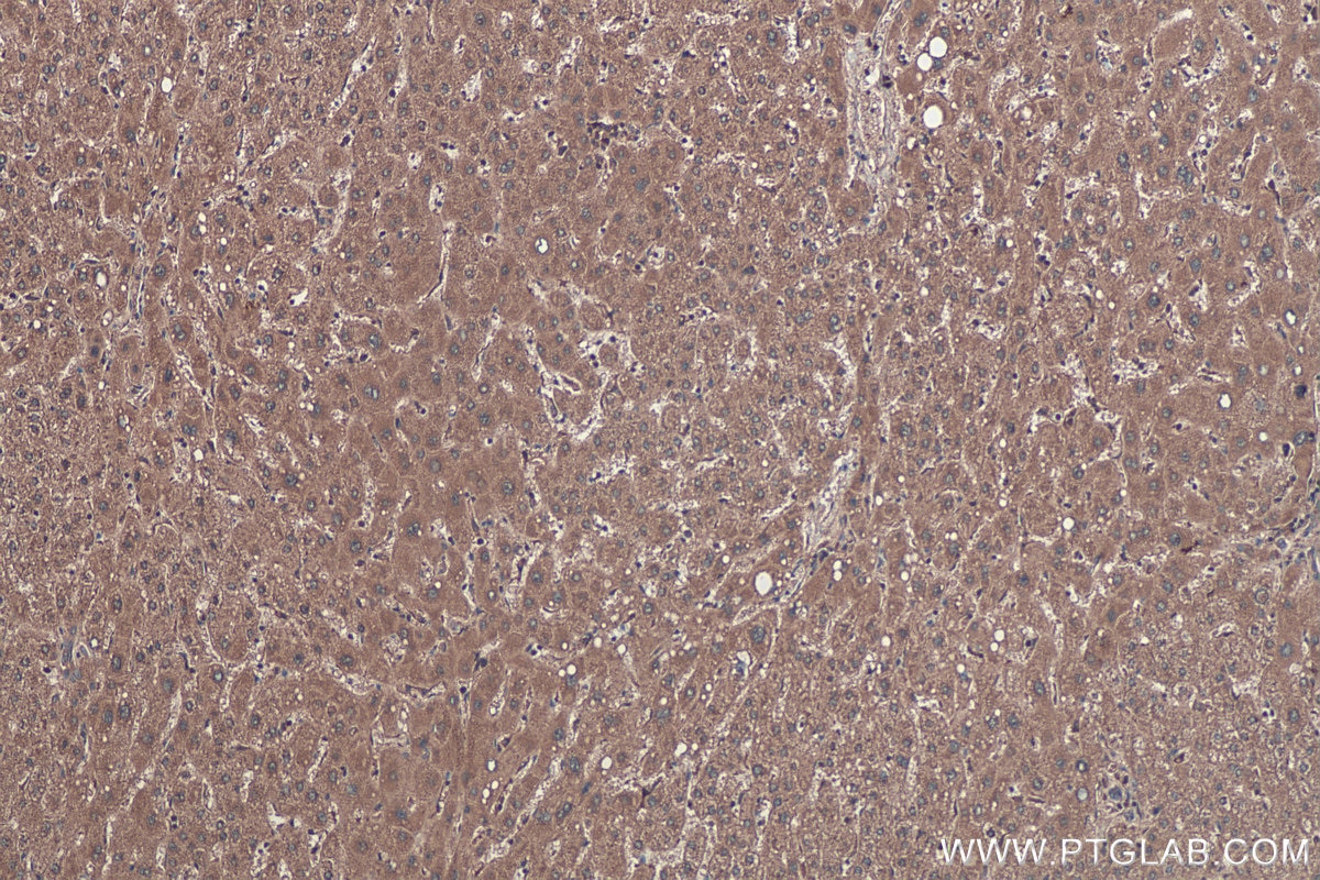 Immunohistochemical analysis of paraffin-embedded human liver tissue slide using KHC0444 (PDLIM7 IHC Kit).