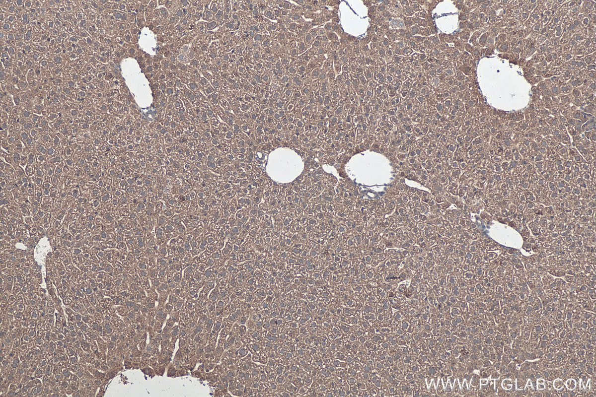 Immunohistochemical analysis of paraffin-embedded mouse liver tissue slide using KHC0444 (PDLIM7 IHC Kit).
