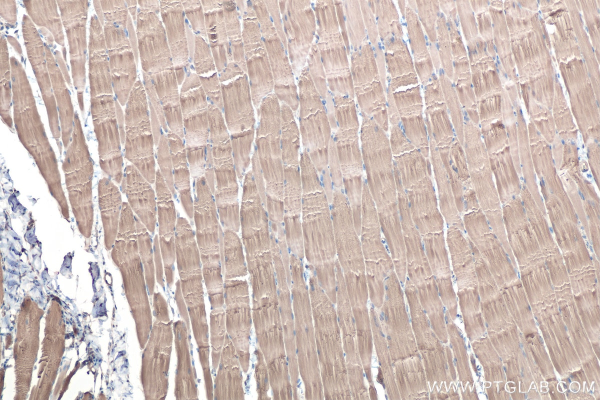 Immunohistochemical analysis of paraffin-embedded rat skeletal muscle tissue slide using KHC0444 (PDLIM7 IHC Kit).