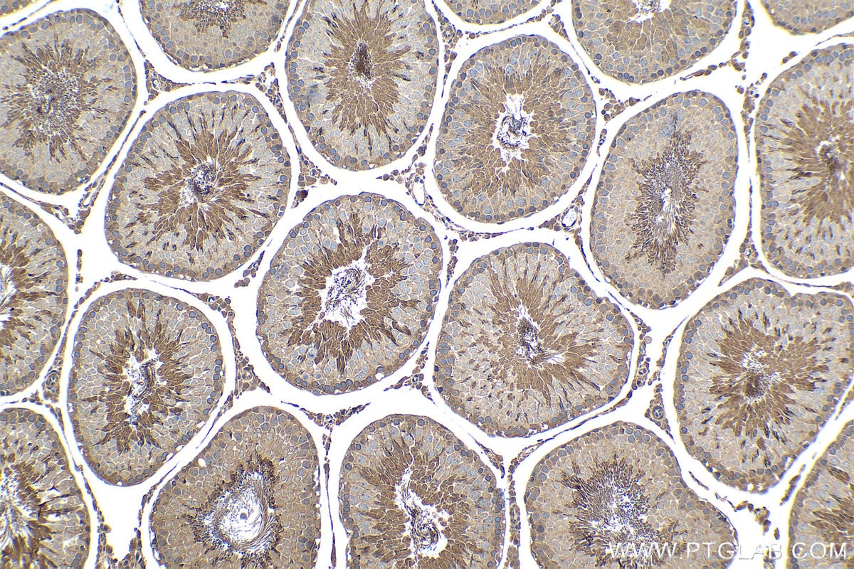 Immunohistochemical analysis of paraffin-embedded rat testis tissue slide using KHC1448 (PDPK1 IHC Kit).