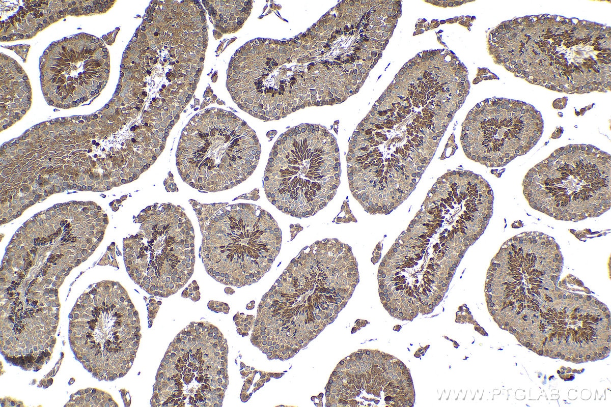 Immunohistochemical analysis of paraffin-embedded mouse testis tissue slide using KHC1448 (PDPK1 IHC Kit).