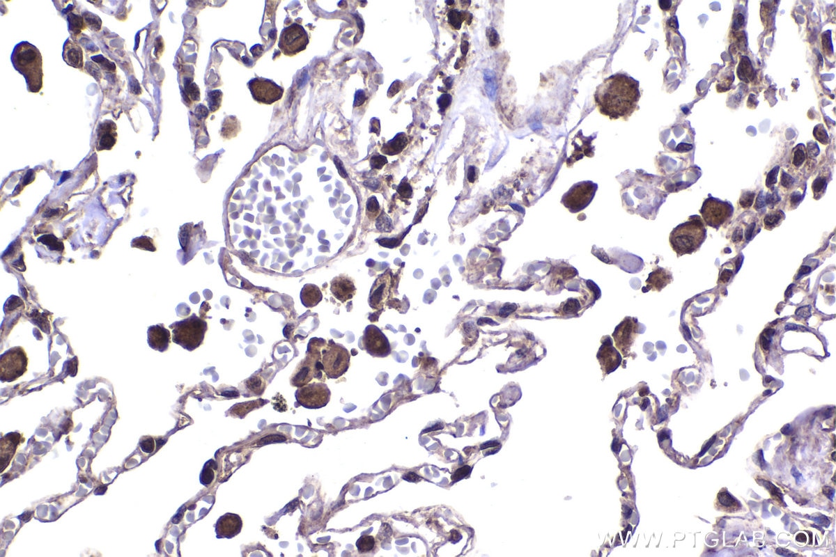 Immunohistochemical analysis of paraffin-embedded human lung tissue slide using KHC1448 (PDPK1 IHC Kit).