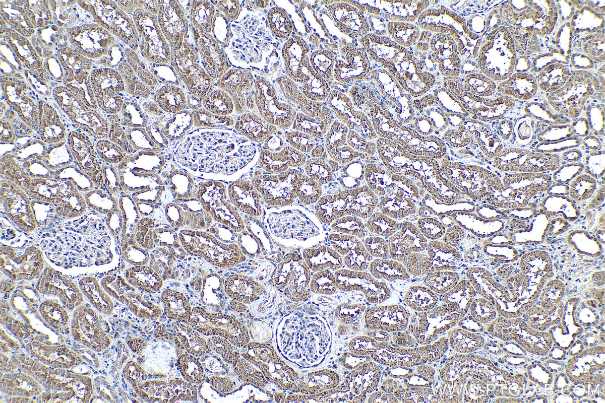 Immunohistochemical analysis of paraffin-embedded human kidney tissue slide using KHC0500 (PEBP1 IHC Kit).