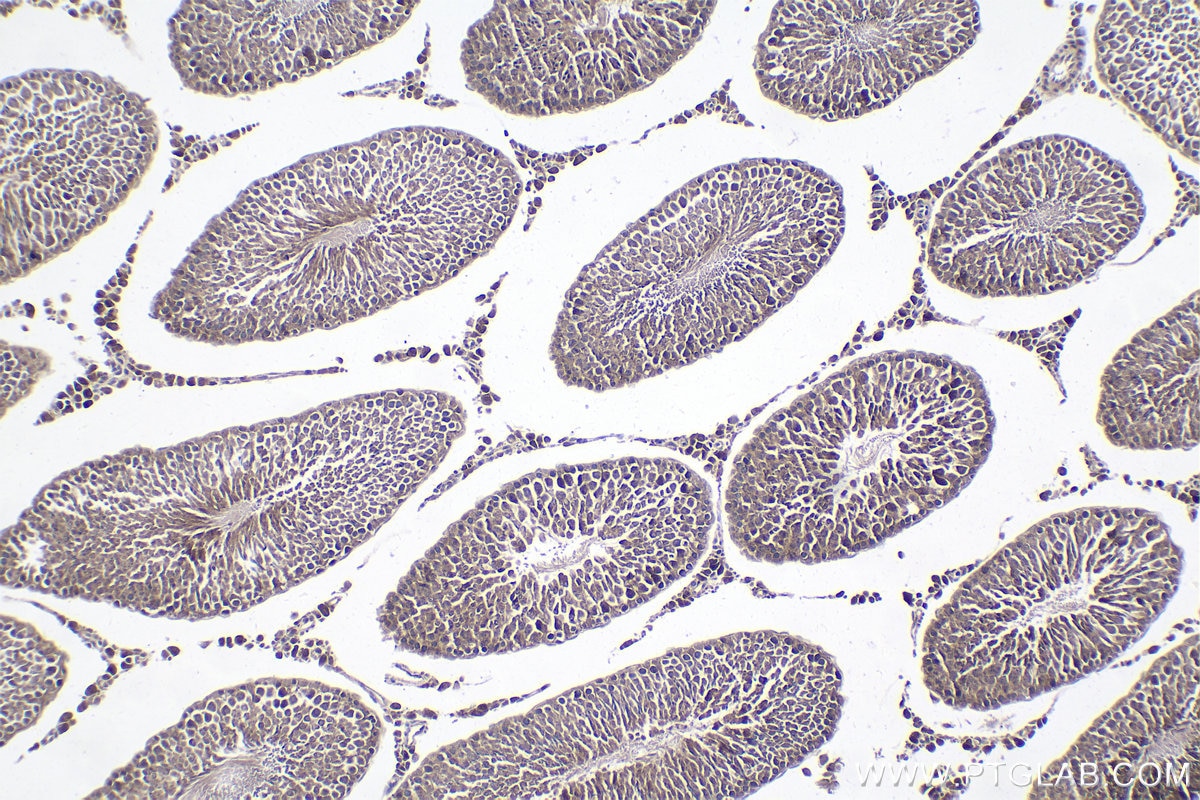 Immunohistochemical analysis of paraffin-embedded rat testis tissue slide using KHC1806 (PEG10 IHC Kit).