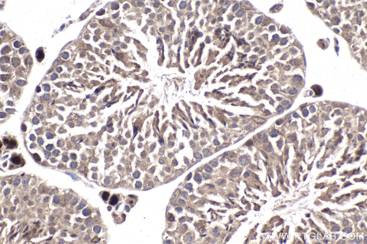 Immunohistochemical analysis of paraffin-embedded mouse testis tissue slide using KHC1806 (PEG10 IHC Kit).