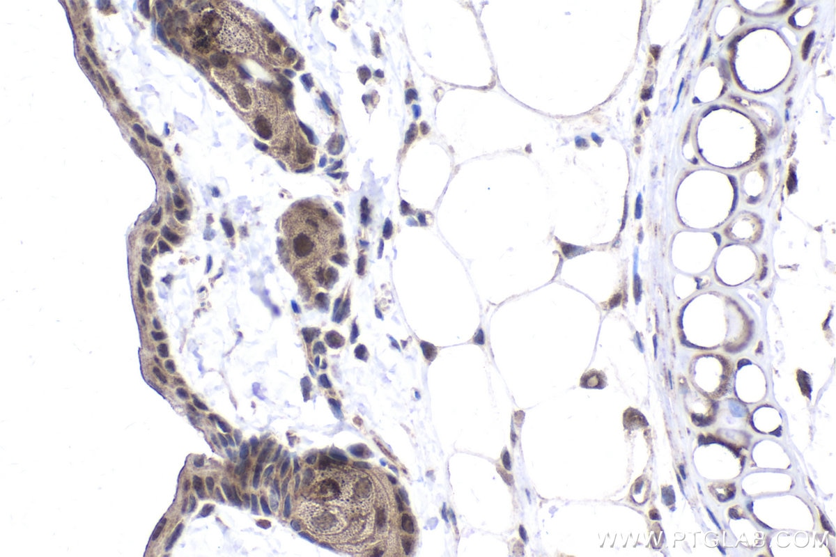 Immunohistochemical analysis of paraffin-embedded rat skin tissue slide using KHC1806 (PEG10 IHC Kit).