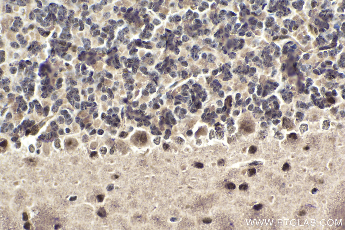 Immunohistochemical analysis of paraffin-embedded rat cerebellum tissue slide using KHC1828 (PELP1 IHC Kit).