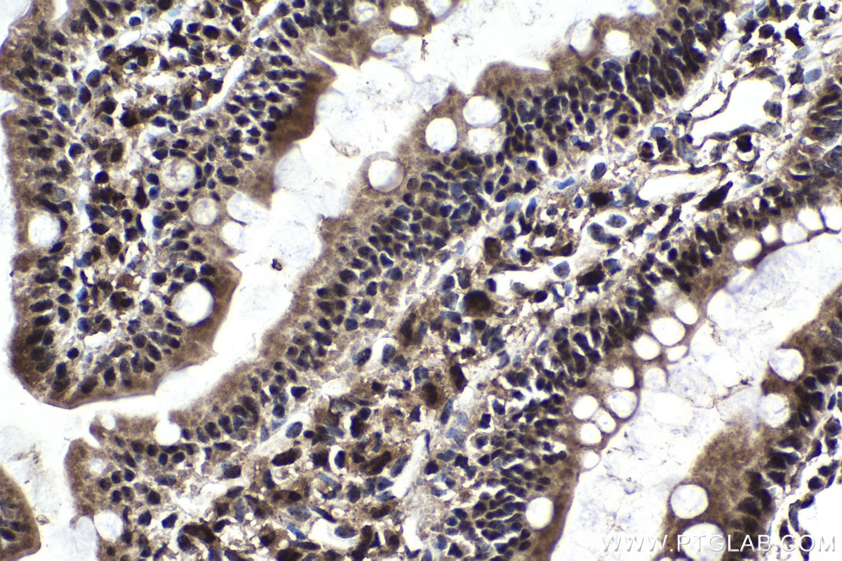 Immunohistochemical analysis of paraffin-embedded rat small intestine tissue slide using KHC1828 (PELP1 IHC Kit).