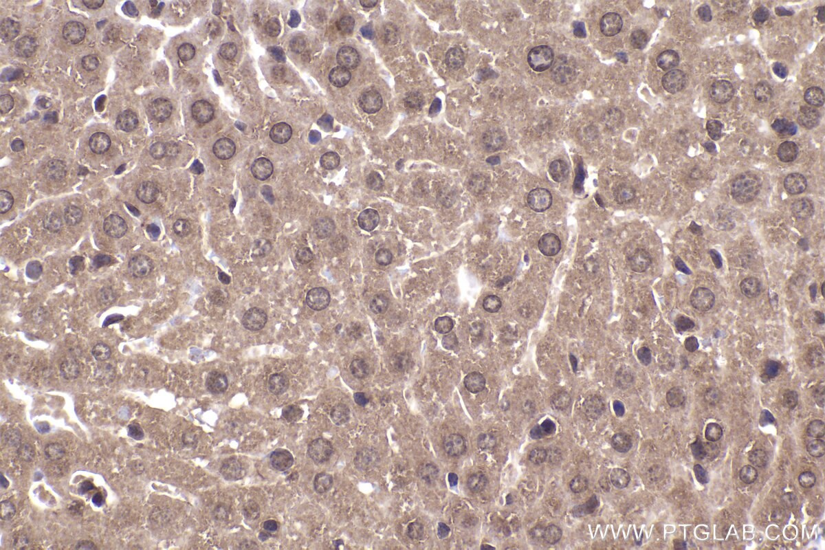 Immunohistochemical analysis of paraffin-embedded mouse liver tissue slide using KHC2331 (PER3 IHC Kit).