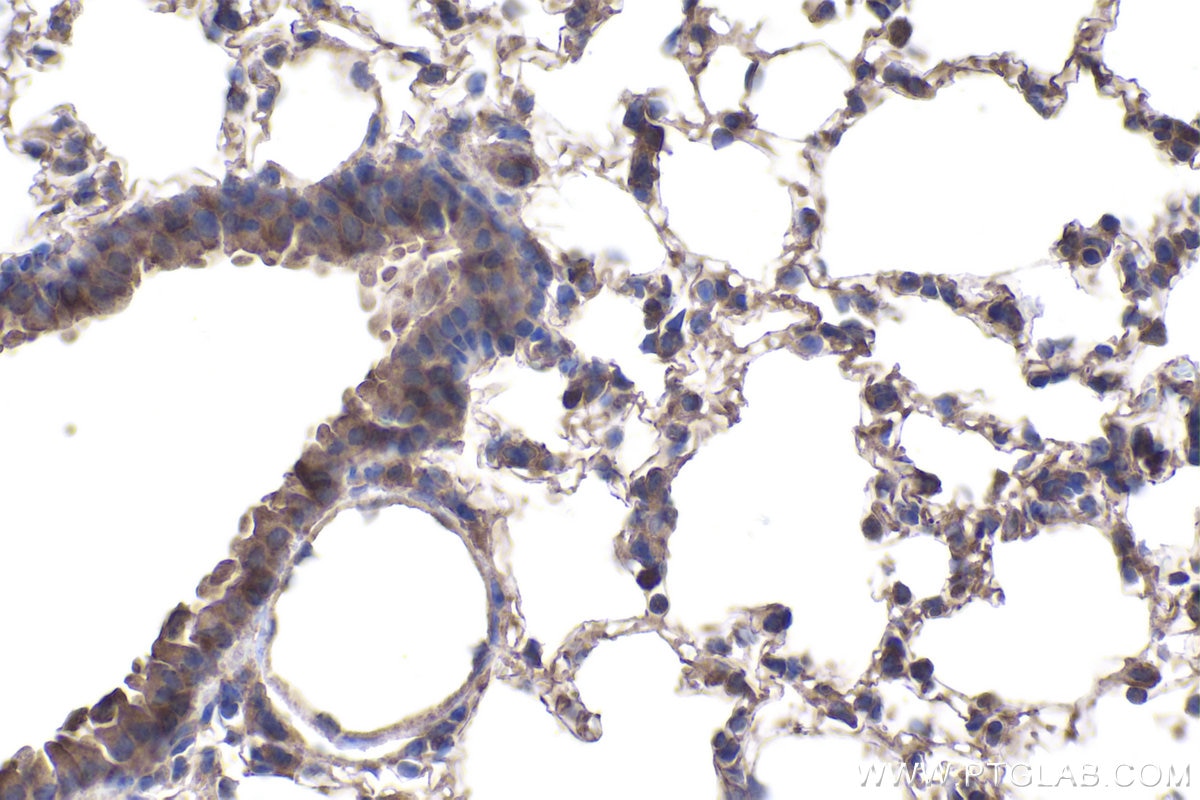 Immunohistochemical analysis of paraffin-embedded mouse lung tissue slide using KHC1959 (PFDN4 IHC Kit).