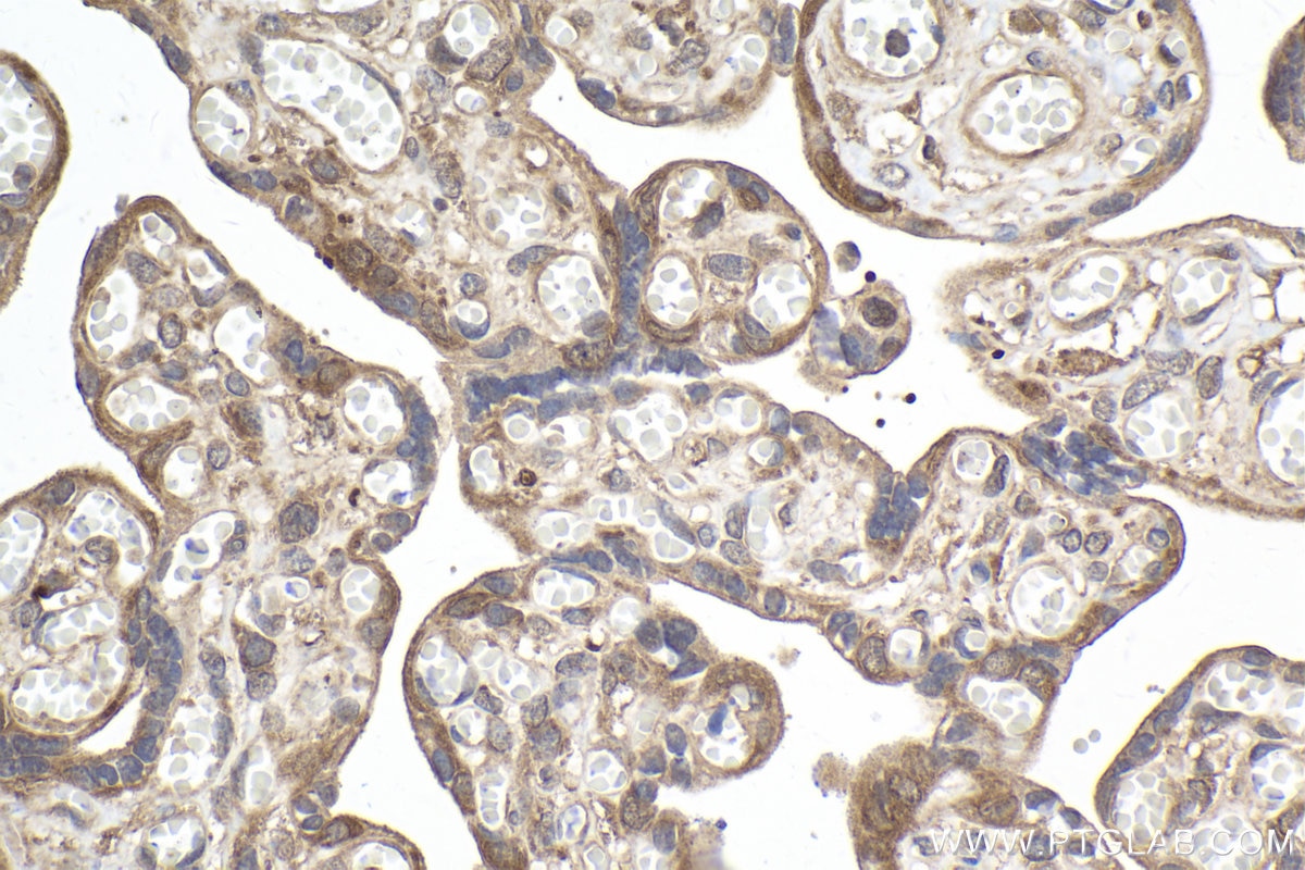 Immunohistochemical analysis of paraffin-embedded human placenta tissue slide using KHC1959 (PFDN4 IHC Kit).