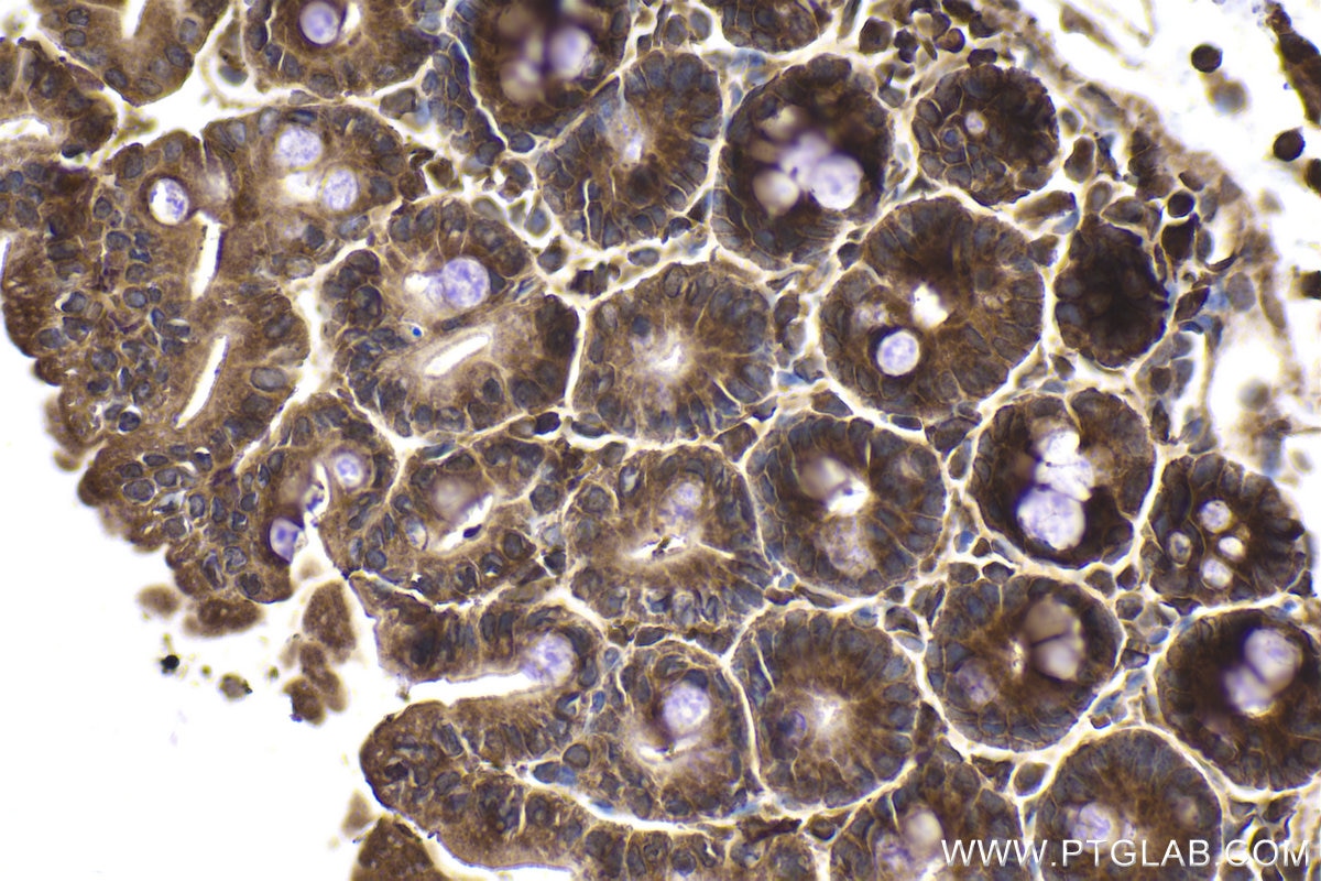 Immunohistochemical analysis of paraffin-embedded mouse small intestine tissue slide using KHC1959 (PFDN4 IHC Kit).