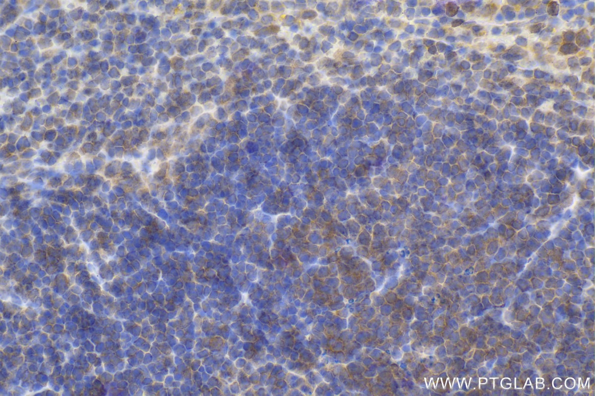 Immunohistochemical analysis of paraffin-embedded mouse spleen tissue slide using KHC1959 (PFDN4 IHC Kit).