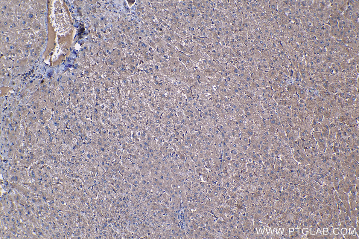 Immunohistochemical analysis of paraffin-embedded human liver tissue slide using KHC1278 (PFKL IHC Kit).