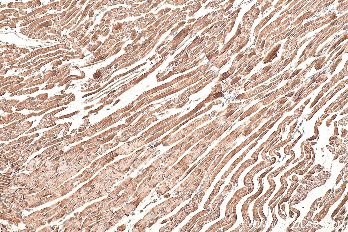 Immunohistochemical analysis of paraffin-embedded mouse heart tissue slide using KHC1007 (PFKM IHC Kit).