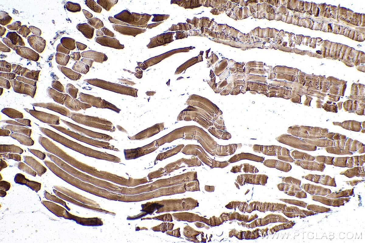 Immunohistochemical analysis of paraffin-embedded mouse skeletal muscle tissue slide using KHC1007 (PFKM IHC Kit).