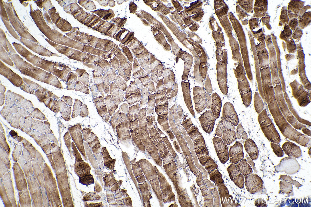 Immunohistochemical analysis of paraffin-embedded rat skeletal muscle tissue slide using KHC1007 (PFKM IHC Kit).