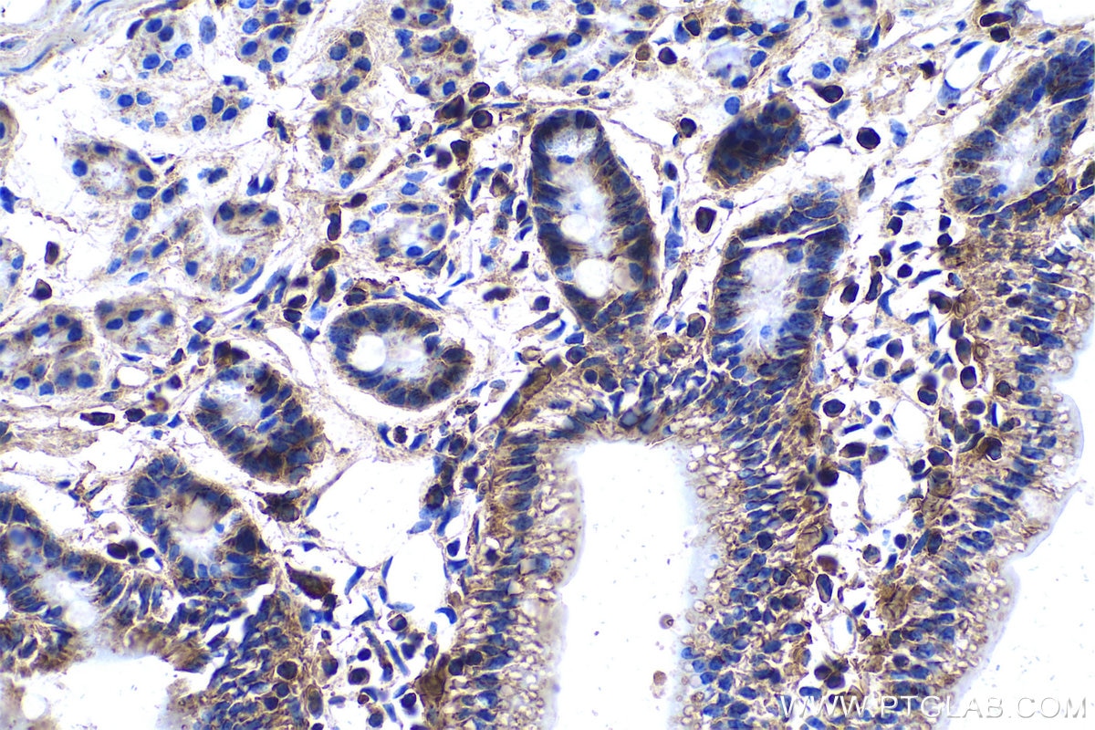 Immunohistochemical analysis of paraffin-embedded mouse small intestine tissue slide using KHC0519 (PFN1 IHC Kit).