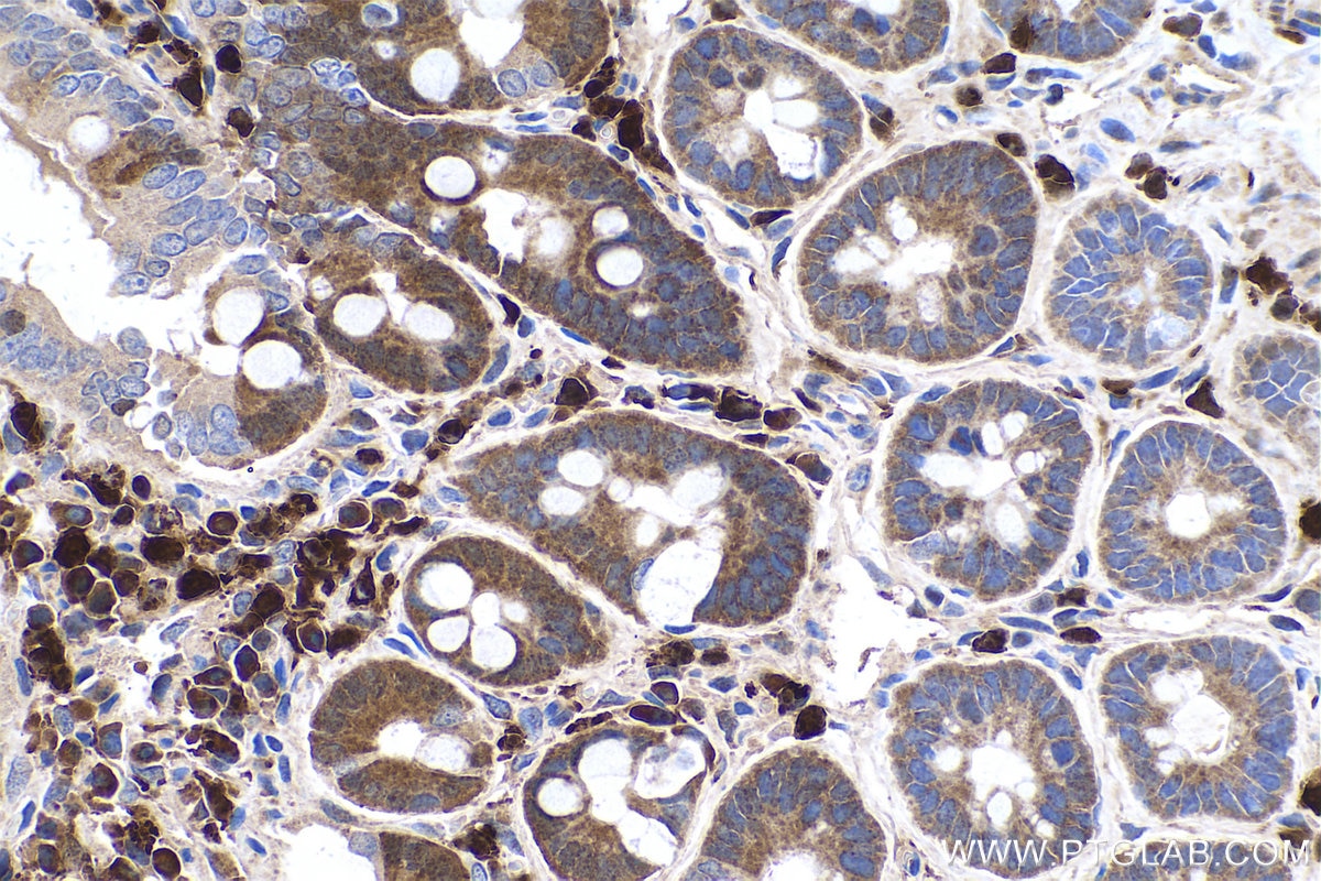 Immunohistochemical analysis of paraffin-embedded rat small intestine tissue slide using KHC0519 (PFN1 IHC Kit).