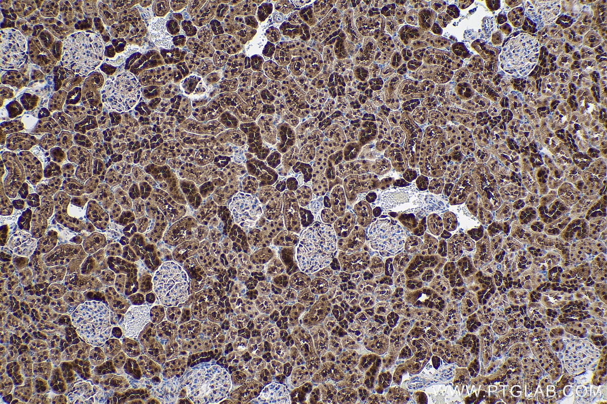 Immunohistochemical analysis of paraffin-embedded rat kidney tissue slide using KHC0542 (PGK1 IHC Kit).