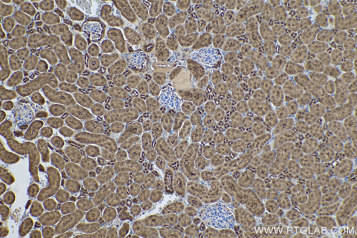 Immunohistochemical analysis of paraffin-embedded mouse kidney tissue slide using KHC0542 (PGK1 IHC Kit).