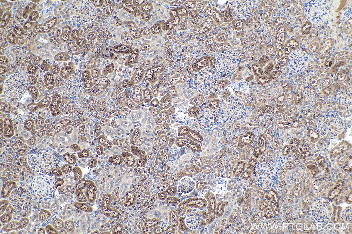 Immunohistochemical analysis of paraffin-embedded rat kidney tissue slide using KHC0546 (PGRMC1 IHC Kit).