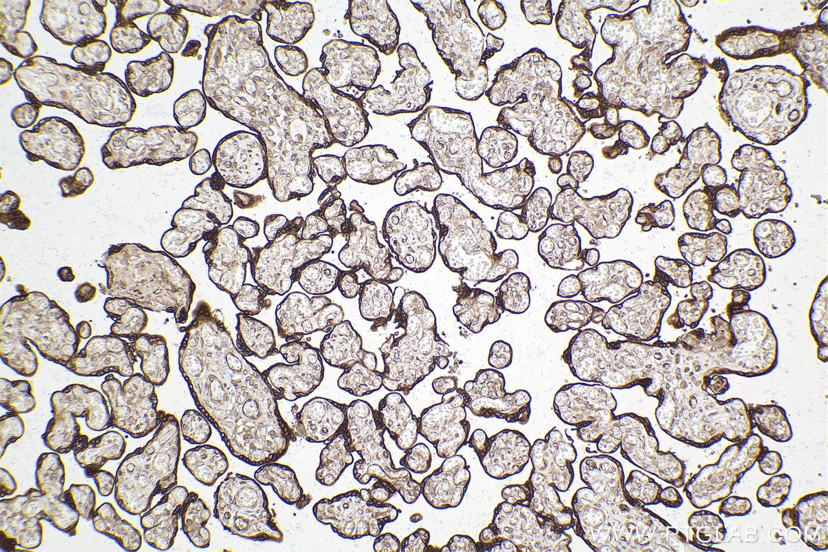 Immunohistochemical analysis of paraffin-embedded human placenta tissue slide using KHC2067 (PGRMC2 IHC Kit).