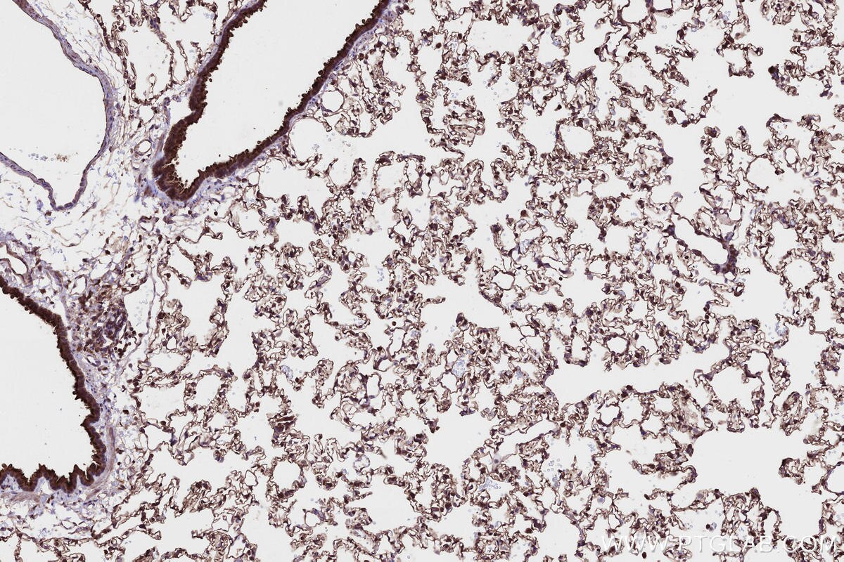 Immunohistochemical analysis of paraffin-embedded rat lung tissue slide using KHC2662 (PHACTR4 IHC Kit).