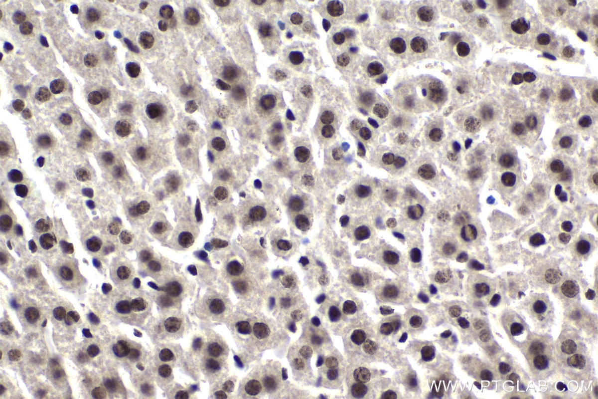 Immunohistochemical analysis of paraffin-embedded mouse liver tissue slide using KHC1822 (PHC2 IHC Kit).