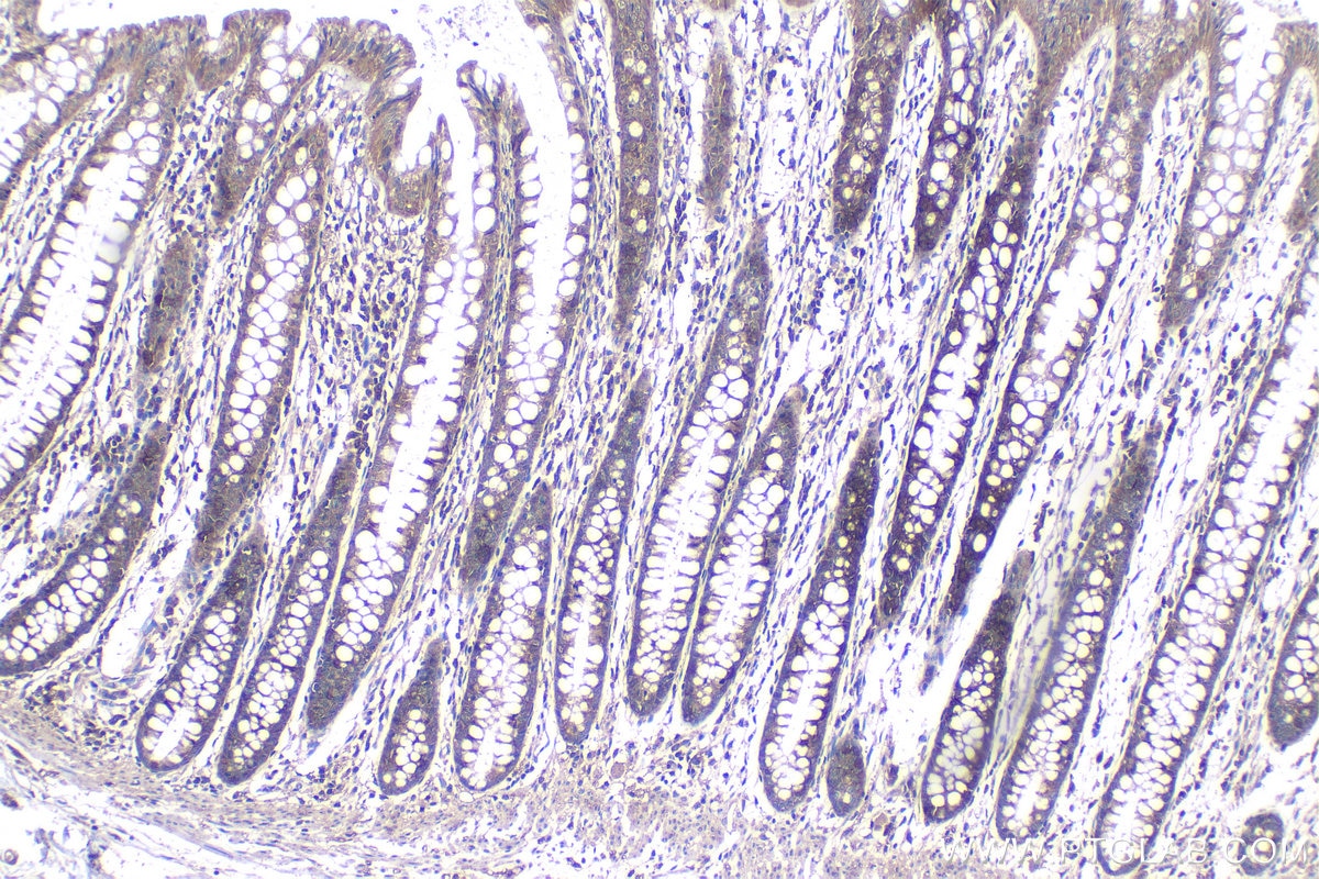 Immunohistochemical analysis of paraffin-embedded human colon tissue slide using KHC1225 (PHD2/EGLN1 IHC Kit).