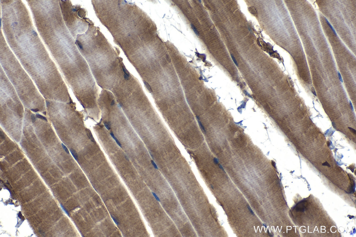 Immunohistochemical analysis of paraffin-embedded mouse skeletal muscle tissue slide using KHC1225 (PHD2/EGLN1 IHC Kit).
